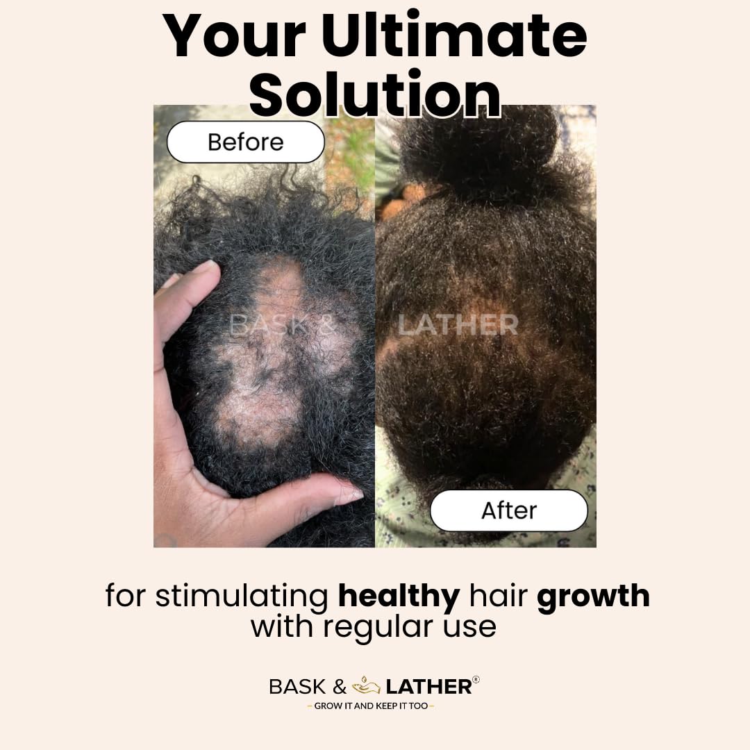 Noirva Scalp Elixir